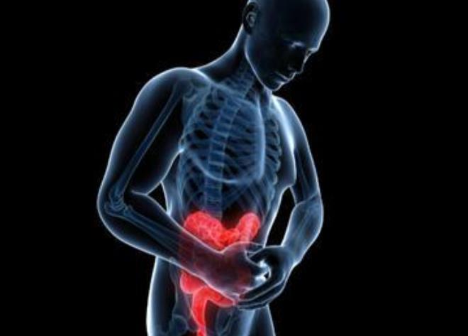 克罗恩病的病理特点有_克罗恩病组织病理_克罗恩病病理诊断要点