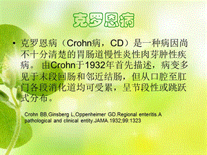 克罗恩病关节炎看什科_克罗恩病关节炎治疗_克罗恩关节炎症指什么