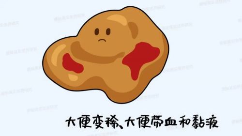 拉粑粑拉鲜血_大便时拉出血来_拉大便时只拉出鲜血