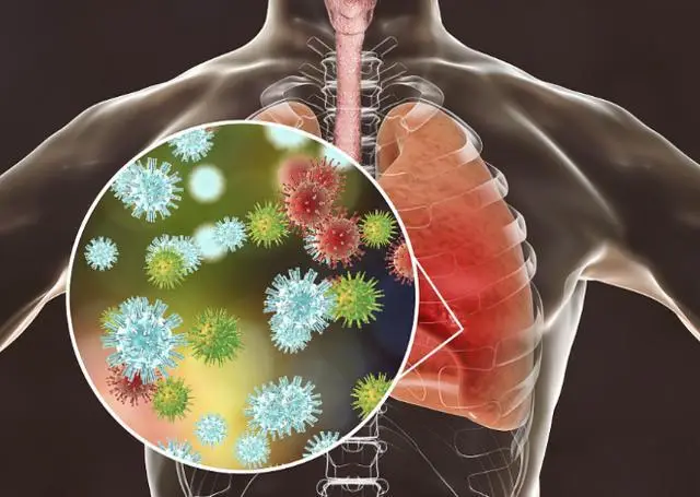 黄痰 白痰 肺炎_肺炎黄痰变白痰但是不好咳出_肺炎黄痰和白痰有什么区别