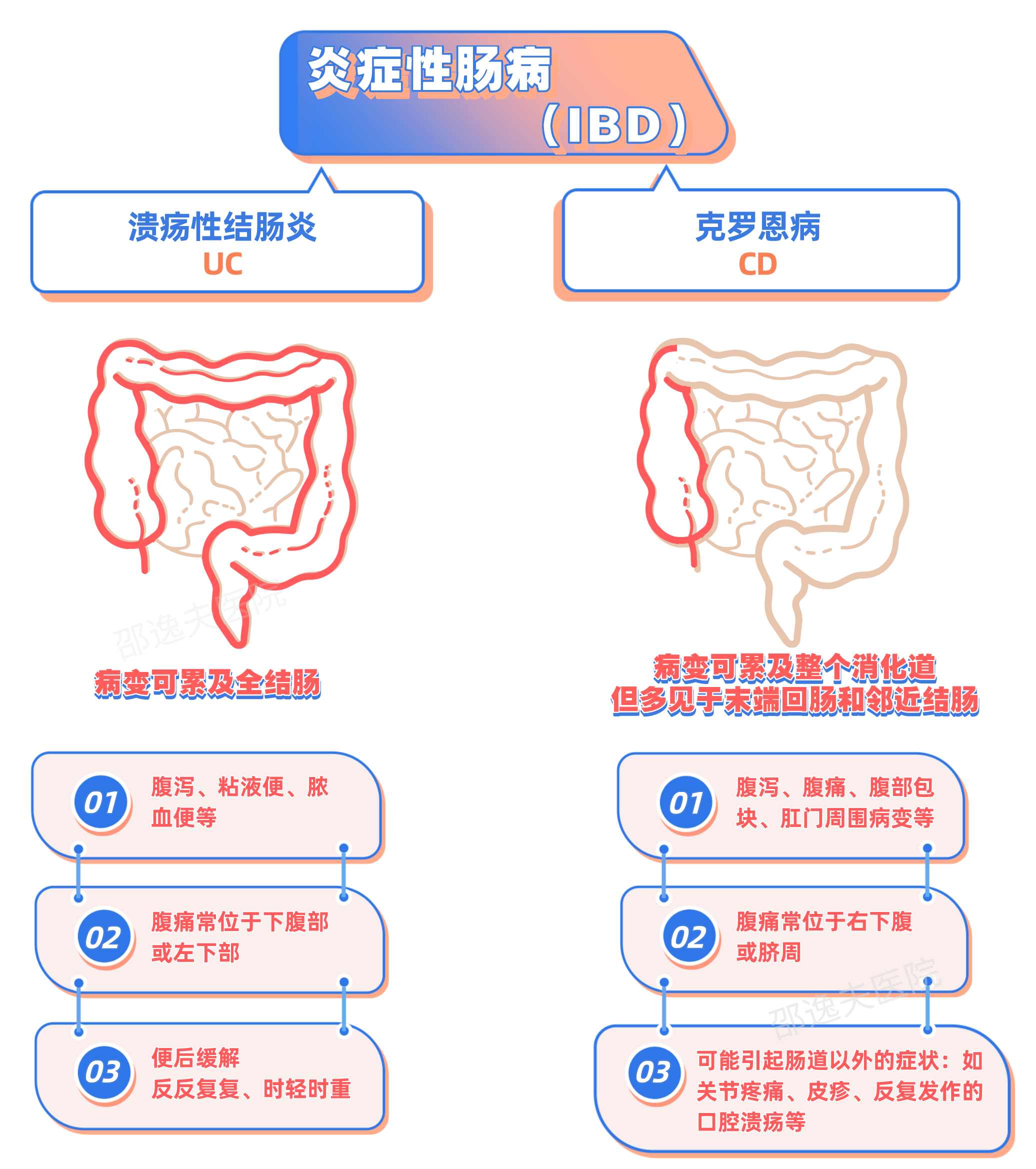 克罗恩病的六大标准_罗克罗恩病_罗克罗恩病的特征性体征