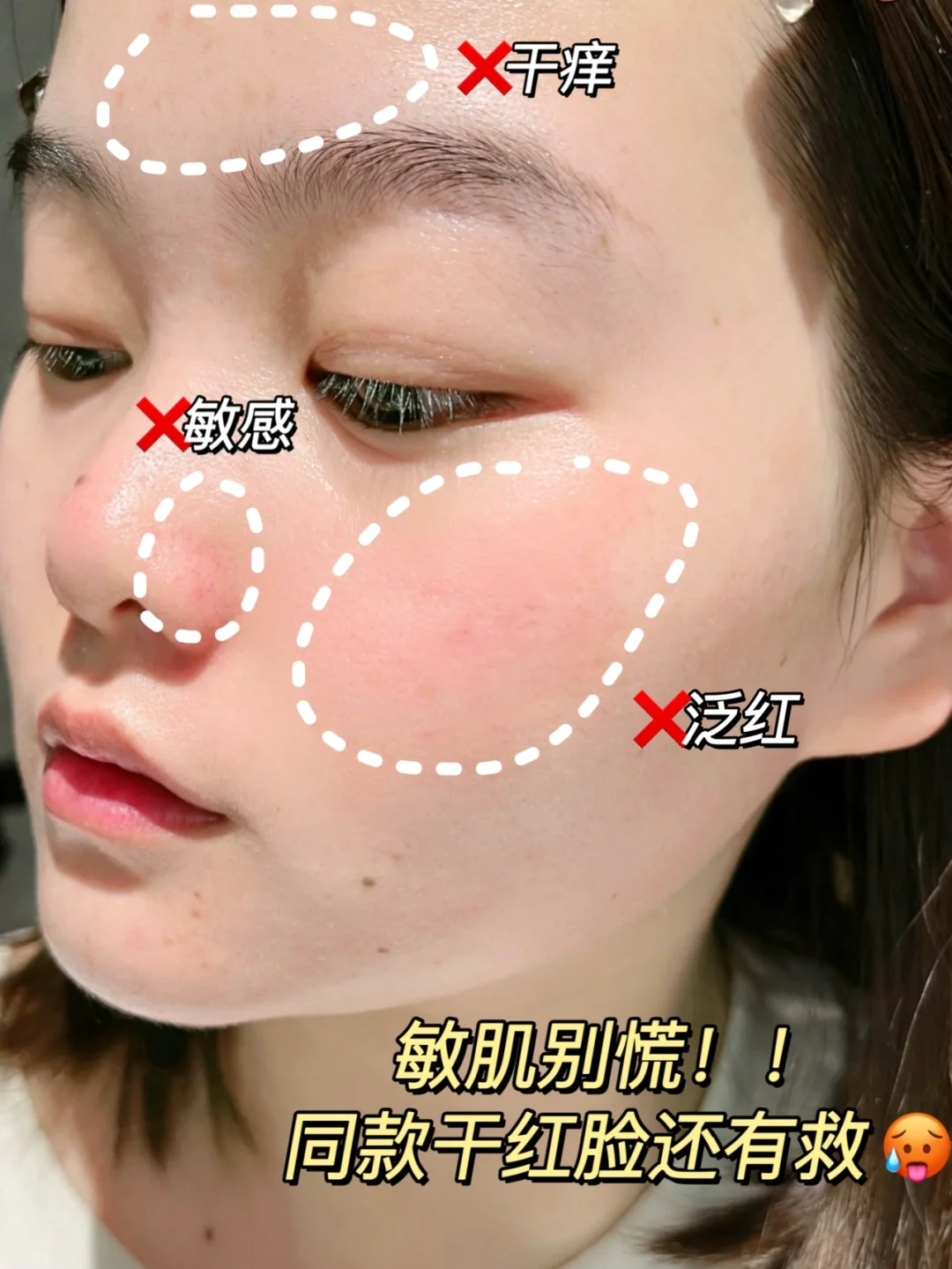 Xvidcore.dll 出问题怎么办？别慌，这里有解决方案