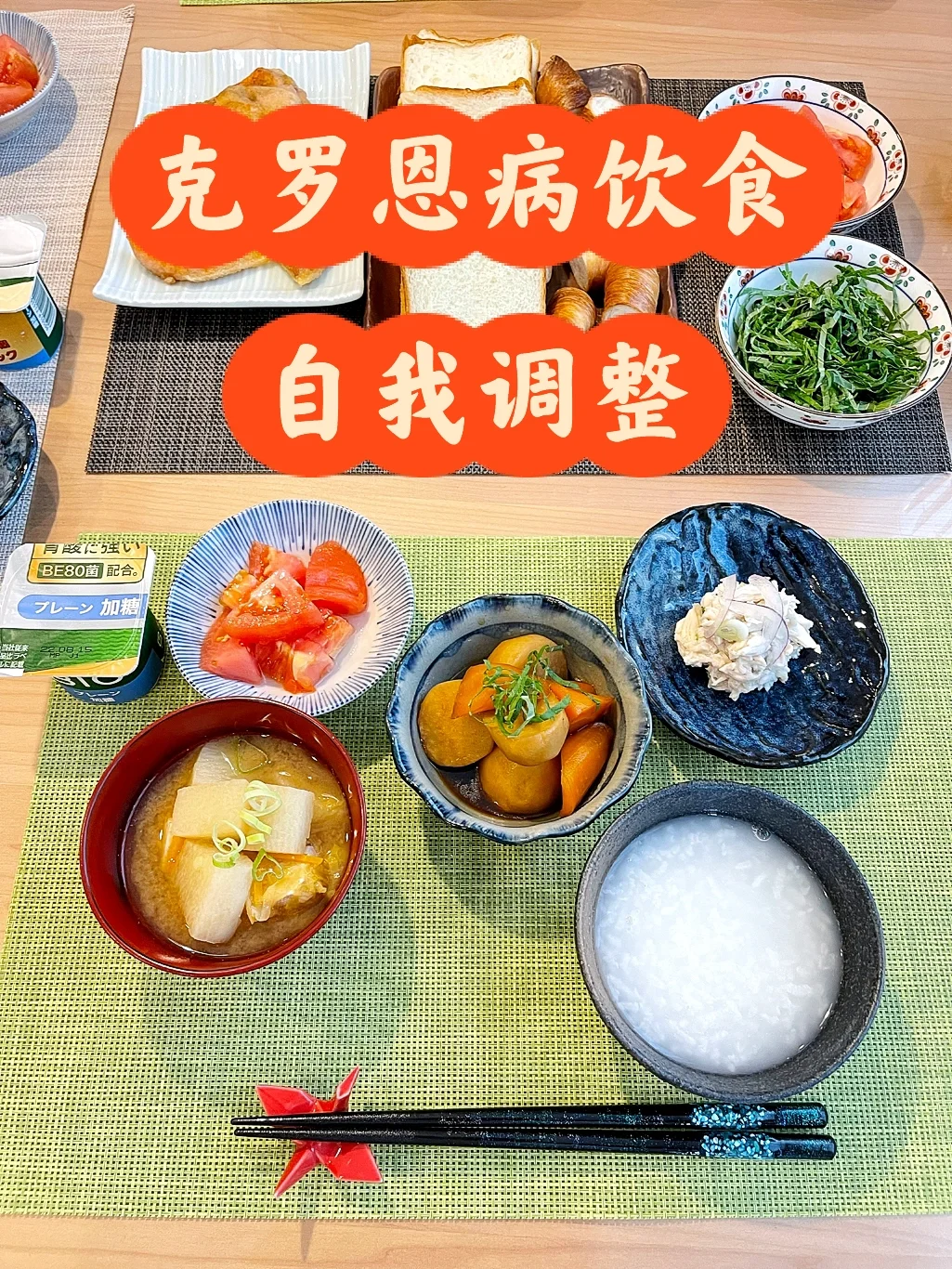 罗克恩病能治好吗_罗克恩病早期症状_克罗恩治疗方法