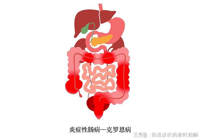克罗恩只能活15年_l克罗恩_克罗恩能活三十年吗