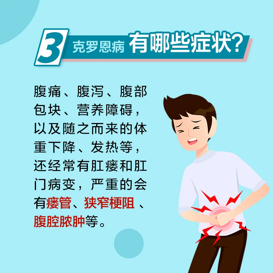罗克罗恩病_治疗克罗恩病类克费用_克罗恩病(cd)