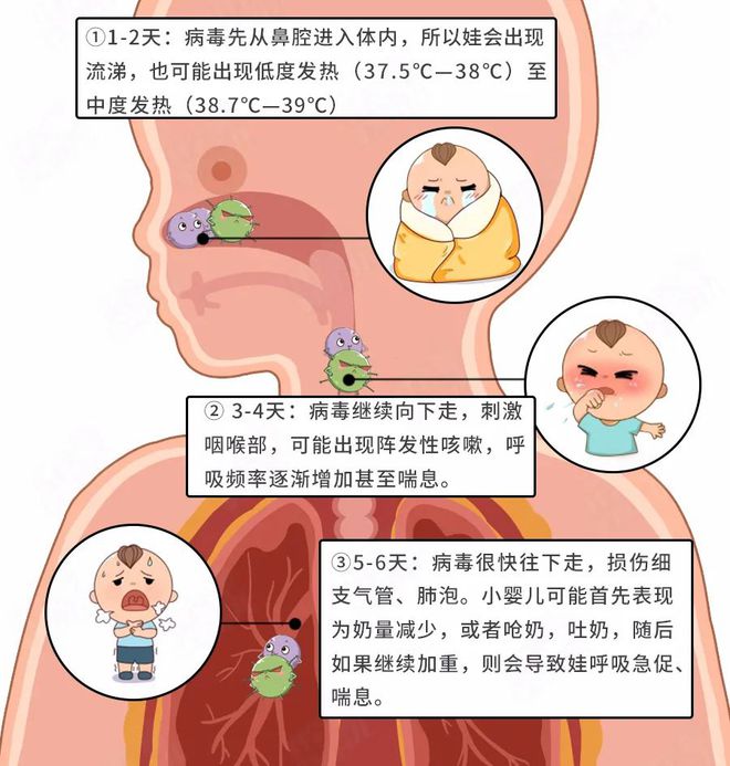 儿童肺炎早期怎么治_儿童肺炎的早期症状_早期症状肺炎儿童能治好吗