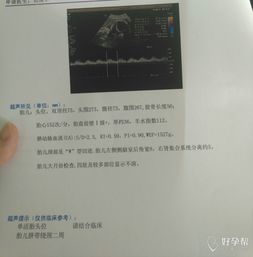 b超肾集合系统分离,原因、诊断与治疗